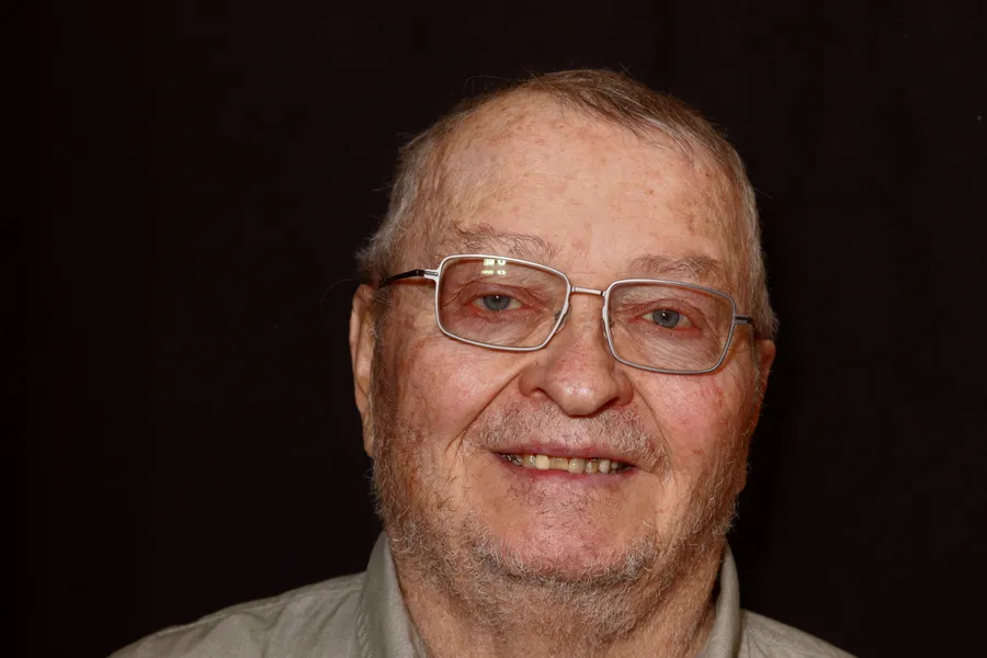 Before, Upper & Lower Locator Dentures: Mark