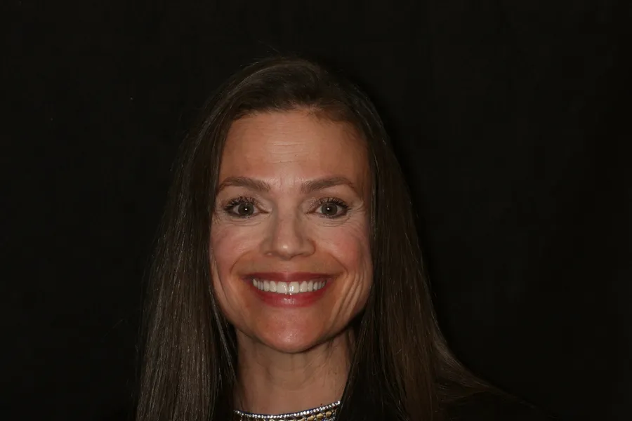 After, 8 Porcelain Veneers: Pam