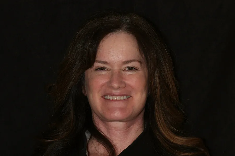Before, 10 Porcelain Veneers: Penny