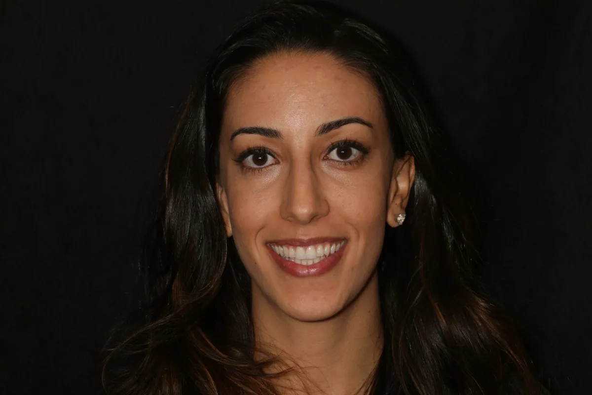 After, 2 Layered Porcelain Veneers: Anisa
