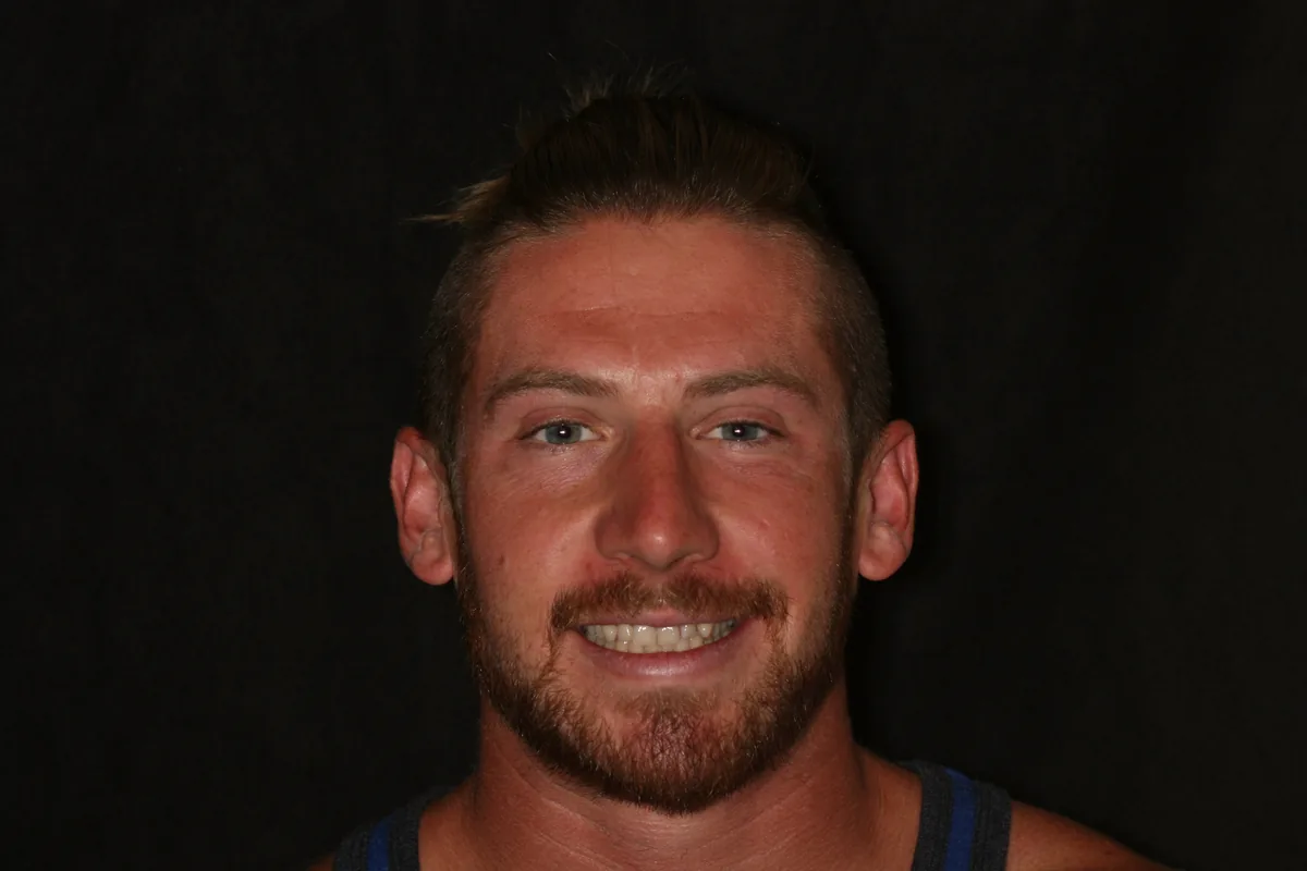 Before, 16 Porcelain Veneers: Jon