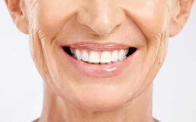 Am I A Candidate For Porcelain Veneers?