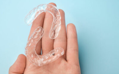 Am I A Candidate For Clear Aligners?