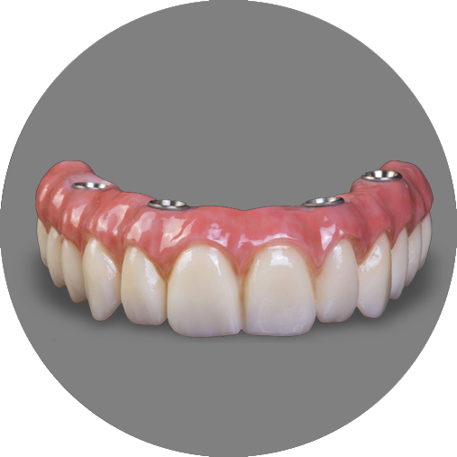 full-arch-dental-implants-circle