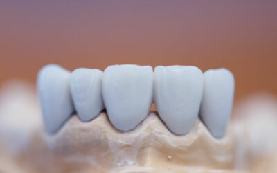 Will The Crowns And Bridges Procedures Restore The Look Of My Smile?