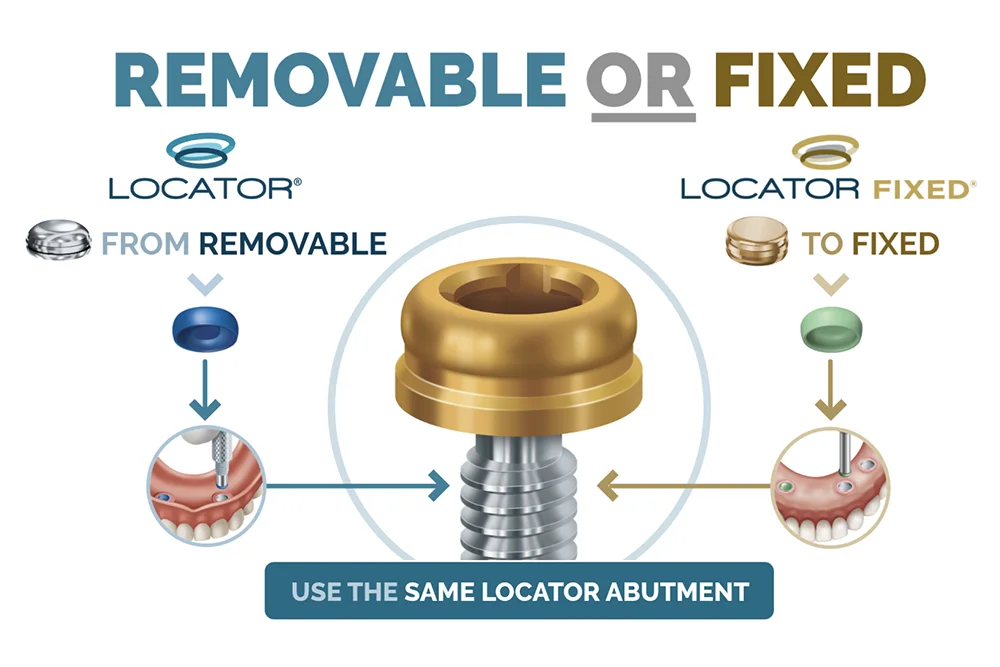 locator-removable-fixed