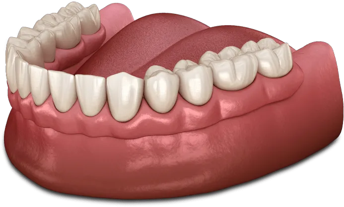 Locator Dentures